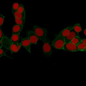 ICC of MCF7 stained with EpCAM Mouse Monoclonal Antibody AE00150