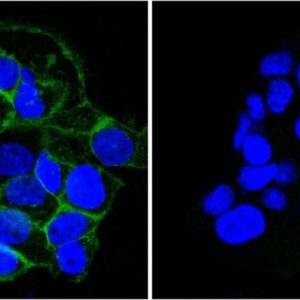 ICC of A431 stained with EGFR Mouse Monoclonal Antibody AE00165