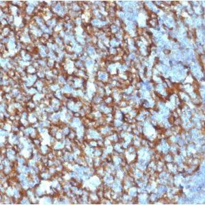 IHC of human tonsil stained with CD21 Mouse Monoclonal Antibody AE00164