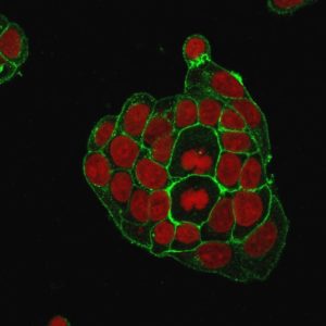 ICC of MCF7 stained with GLUT-1 Mouse Monoclonal Antibody AE00202