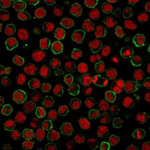 ICC of Raji stained with CD20 Mouse Monoclonal Antibody AE00203