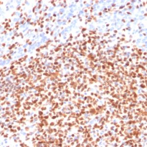 IHC of human lymph node stained with POU2F2 Mouse Monoclonal Antibody AE00201