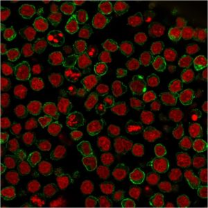 ICC of Ramos stained with Ki-67 Mouse Monoclonal Antibody AE00204