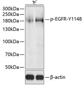 WB of A431 stained with EGFR-pY1148 Rabbit Phospho-Specific Polyclonal Antibody AE00214