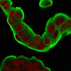 ICC of MCF7 stained with HSP27 Mouse Monoclonal Antibody AE00228