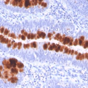 IHC of human colon stained with CD95 Mouse Monoclonal Antibody AE00224