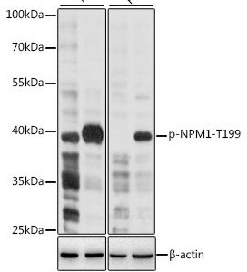 WB of HeLa and PC12 stained with NPM1-pT119 Rabbit Phospho-Specific Polyclonal Antibody AE00223