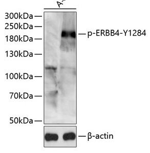 WB of A431 stained with ERBB4-pY1284 Rabbit Phospho-Specific Polyclonal Antibody AE00227