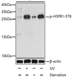 WB of HeLa stained with HSPB1-pS78 Rabbit Phospho-Specific Polyclonal Antibody AE00231