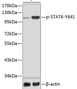 WB of HeLa stained with STAT6-pY641 Rabbit Phospho-Specific Polyclonal Antibody AE00236