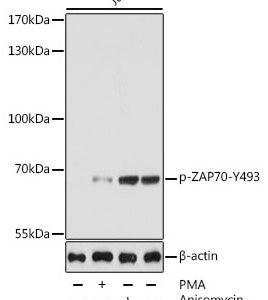 WB of Jurkat stained with ZAP70-pY493 Rabbit Phospho-Specific Polyclonal Antibody AE00241