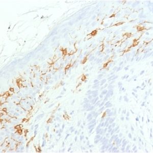 IHC of human skin stained with CD1a Rabbit Recombinant Monoclonal Antibody AE00242