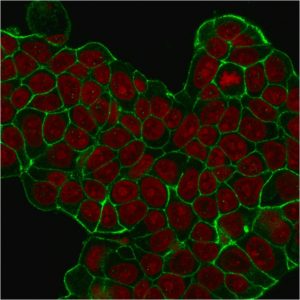 ICC of MCF7 stained with HER2 mouse Monoclonal Antibody AE00271