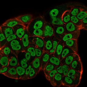 ICC of MCF7 stained with HER2 mouse Monoclonal Antibody AE00273