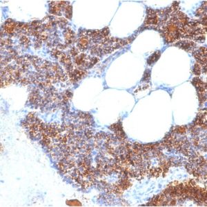 IHC of human parathyroid gland stained with PTH Rabbit Recombinant Monoclonal Antibody AE00286