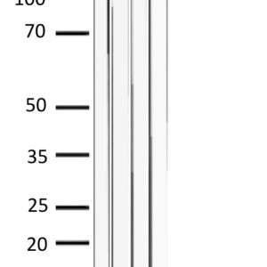 WB of mouse and rat liver stained with EGFR-pY845 Rabbit Polyclonal Antibody AE00302