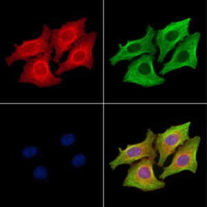 ICC of LPS-treated HepG2 stained with EGFR-pY1086 rabbit Polyclonal Antibody AE00307