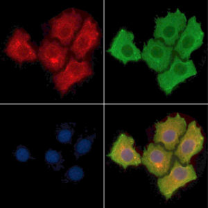 ICC of LPS-treated HepG2 stained with EGFR-pY1173 rabbit Polyclonal Antibody AE00309