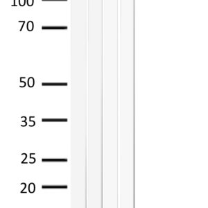 WB of mouse and rat liver stained with EGFR-pS1046 Rabbit Polyclonal Antibody AE00305