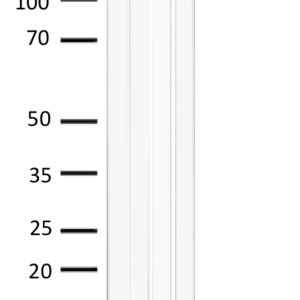 WB of mouse and rat liver stained with EGFR-pS1047 Rabbit Polyclonal Antibody AE00306