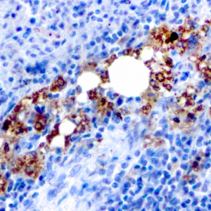 IHC of human spleen stained with TRAP/ACP5 Mouse Recombinant Monoclonal Antibody AE00100