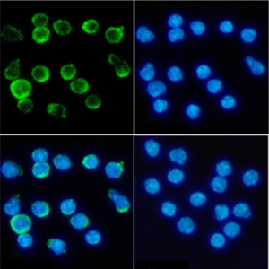 ICC of mouse splenocytes stained with CD137 Rabbit Recombinant Antibody AE00313
