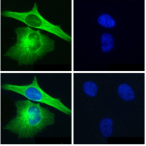 ICC of HeLa stained with TUBA1A Rabbit Recombinant Antibody AE00320