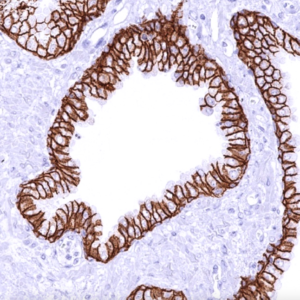 IHC of prostate stained with CDH1 Rabbit Recombinant Antibody AE00365