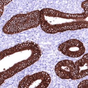 IHC of human endometrium stained with EpCAM Rabbit Recombinant Antibody AE00367